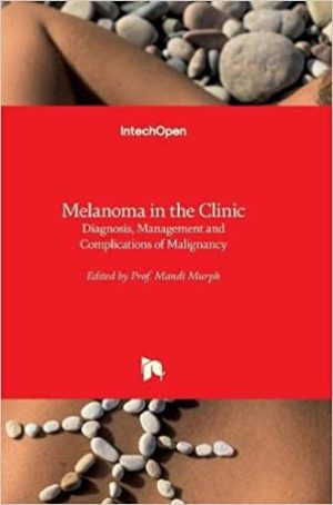 Melanoma in the Clinic Diagnosis Management and Complications of Malignancy