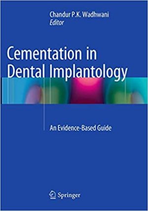 Cementation in Dental Implantology An Evidence Based Guide