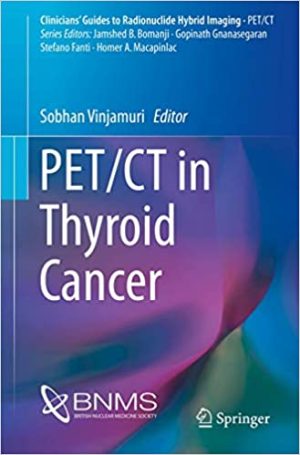 PET CT in Thyroid Cancer