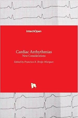 Cardiac Arrhythmias New Considerations