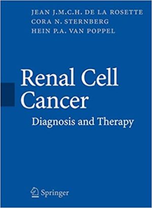 Renal Cell Cancer Diagnosis and Therapy
