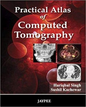 Practical Atlas of Computed Tomography