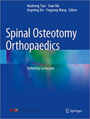 Spinal Osteotomy Orthopaedics Deformity Correction