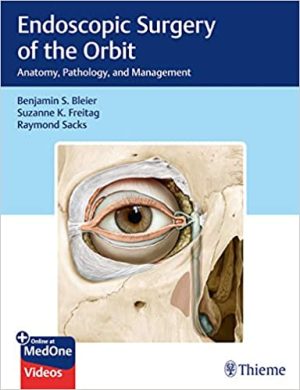 Endoscopic Surgery Of The Orbit Anatomy Pathology And Management