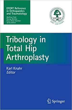 Tribology in Total Hip Arthroplasty