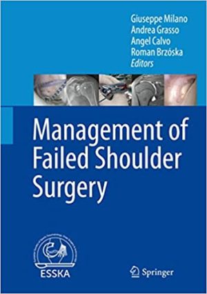 Management of Failed Shoulder Surgery