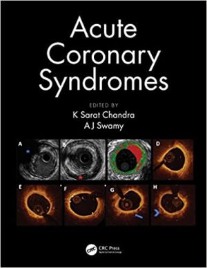 Acute Coronary Syndromes By K Sarat Chandra