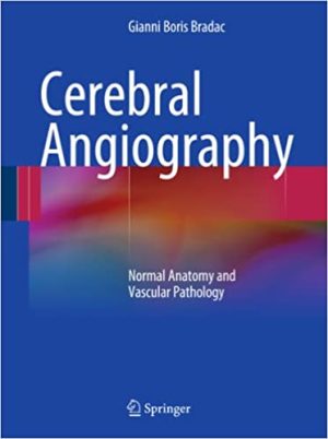 Cerebral Angiography Normal Anatomy and Vascular Pathology