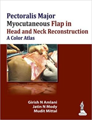 Pectoralis Major Myocutaneous Flap in Head and Neck Reconstruction A Color Atlas