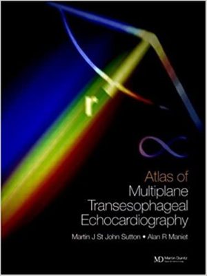 An Atlas of Multiplane Transesophageal Echocardiography