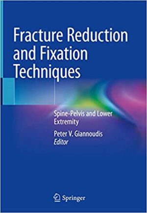 Fracture Reduction and Fixation Techniques Spine Pelvis and Lower Extremity