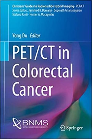 PET CT in Colorectal Cancer