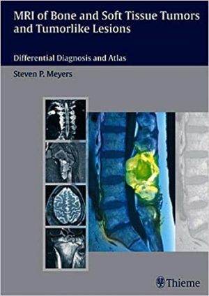 MRI of Bone and Soft Tissue Tumors and Tumorlike Lesions Differential Diagnosis and Atlas