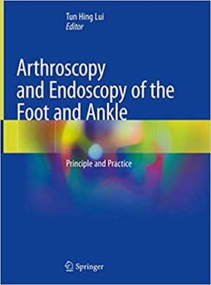 Arthroscopy and Endoscopy of the Foot and Ankle Principle and Practice