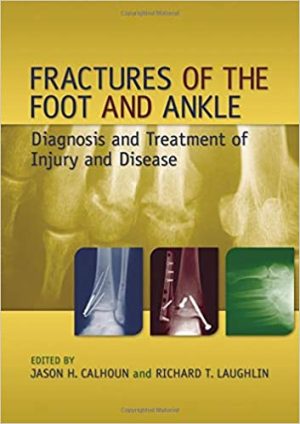 Fractures of the Foot and Ankle Diagnosis and Treatment of Injury and Disease