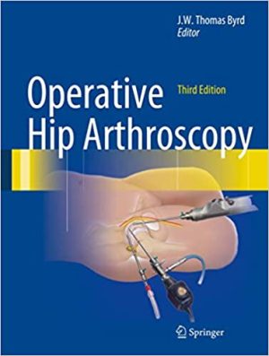 Operative Hip Arthroscopy 3rd Edition