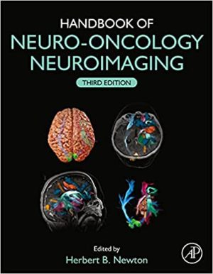 Handbook of Neuro Oncology Neuroimaging 3rd Edition
