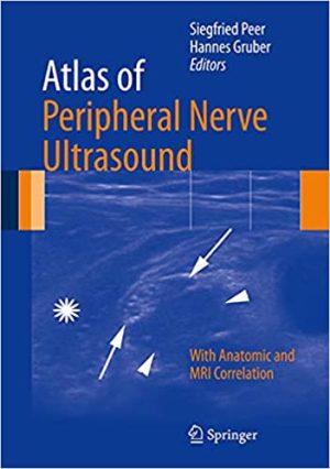 Atlas of Peripheral Nerve Ultrasound With Anatomic and MRI Correlation