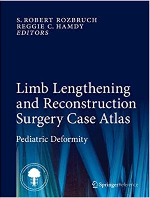 Limb Lengthening and Reconstruction Surgery Case Atlas Pediatric Deformity