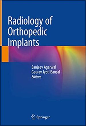Radiology of Orthopedic Implants