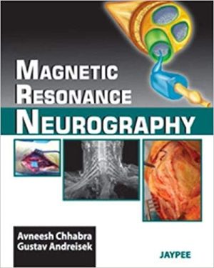 Magnetic Resonance Neurography