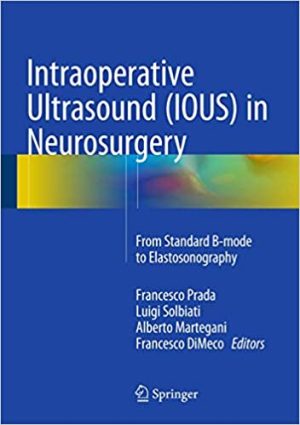 Intraoperative Ultrasound (IOUS) in Neurosurgery From Standard B Mode to Elastosonography