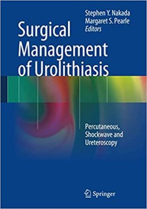 Surgical Management of Urolithiasis Percutaneous Shockwave and Ureteroscopy