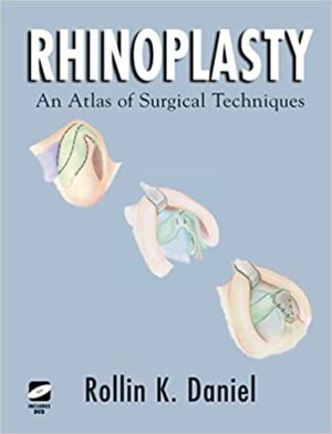 Rhinoplasty An Atlas of Surgical Techniques