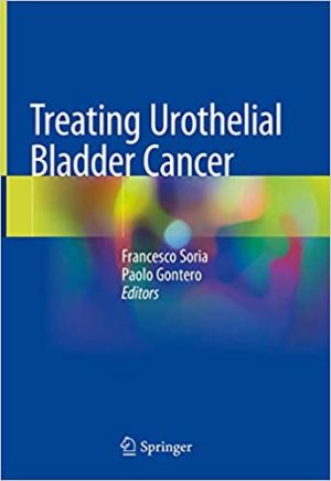 Treating Urothelial Bladder Cancer