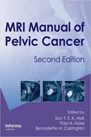 MRI Manual of Pelvic Cancer 2nd Edition
