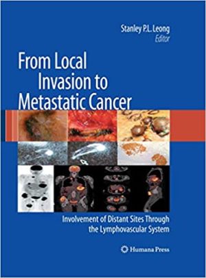 From Local Invasion to Metastatic Cancer Involvement of Distant Sites Through the Lymphovascular System