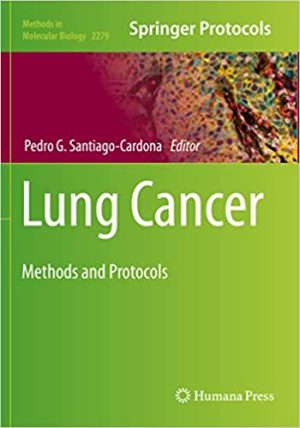Lung Cancer Methods and Protocols
