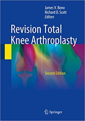 Revision Total Knee Arthroplasty 2nd Ed