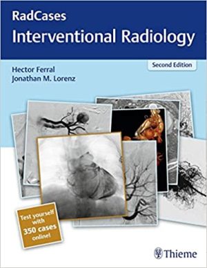 Radcases Interventional Radiology 2nd Edition