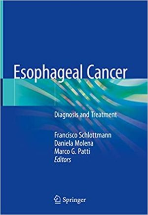 Esophageal Cancer Diagnosis and Treatment