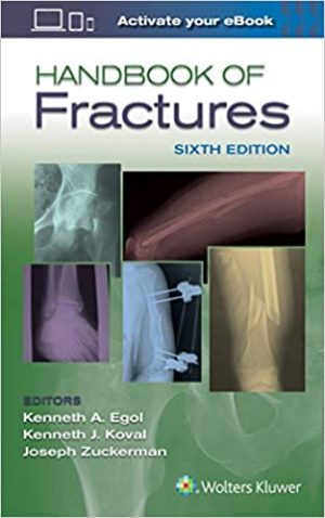 Handbook of Fractures 6th Ed