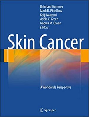Skin Cancer A World Wide Perspective