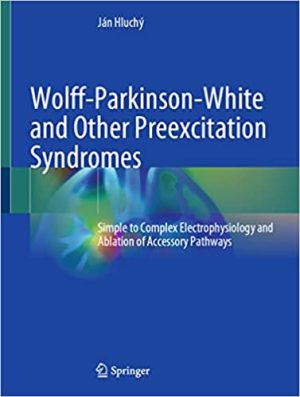 Wolff Parkinson White and Other Preexcitation Syndromes Simple to Complex Electrophysiology and Ablation of Accessory Pathways