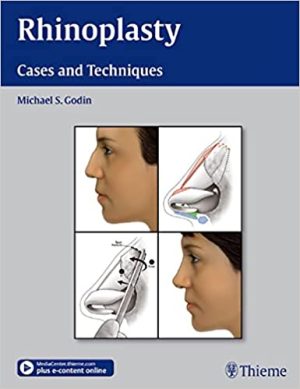 Rhinoplasty Cases and Techniques