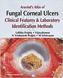 Aravinds Atlas Of Fungal Corneal Ulcers Clinical Features And Laboratory Identification Methods