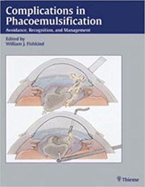 Complications in Phacoemulsification Avoidance Recognition and Management