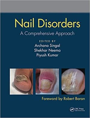 Nail Disorders A Comprehensive Approach