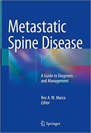 Metastatic Spine Disease A Guide to Diagnosis and Management