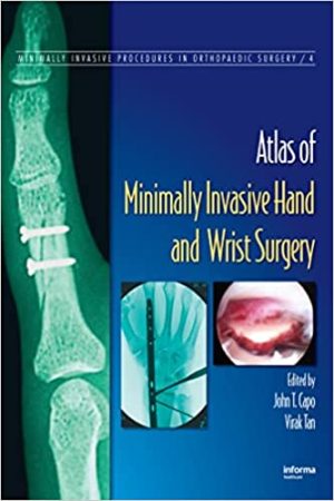 Atlas of Minimally Invasive Hand and Wrist Surgery