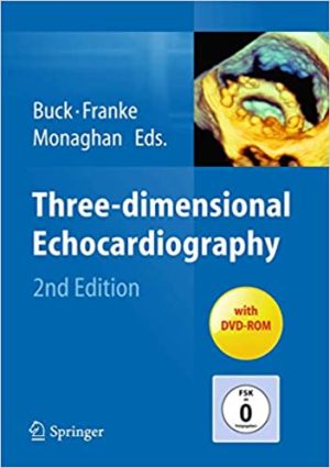 Three Dimensional Echocardiography 2nd Second