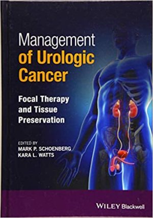 Management of Urologic Cancer Focal Therapy and Tissue Preservation