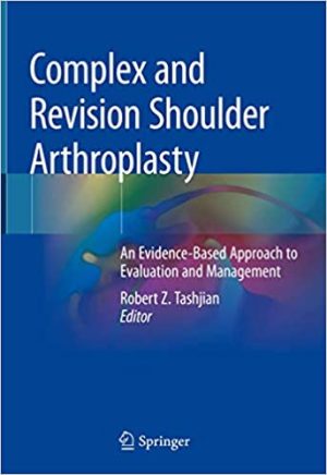 Complex and Revision Shoulder Arthroplasty An Evidence Based Approach to Evaluation and Management