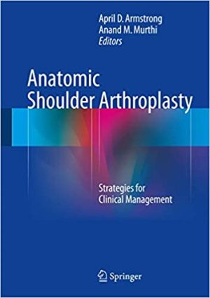 Anatomic Shoulder Arthroplasty Strategies for Clinical Management