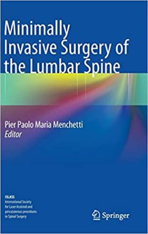 Minimally Invasive Surgery of the Lumbar Spine