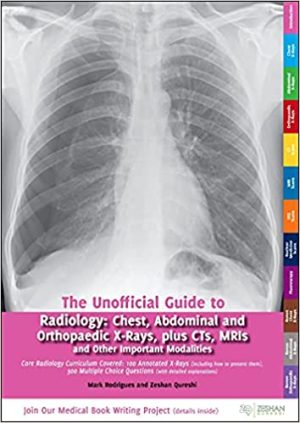 Unofficial Guide to Radiology Chest Abdominal and Orthopaedic X Rays Plus CTs MRIs and Other Important Modalities Core Radiology Curriculum